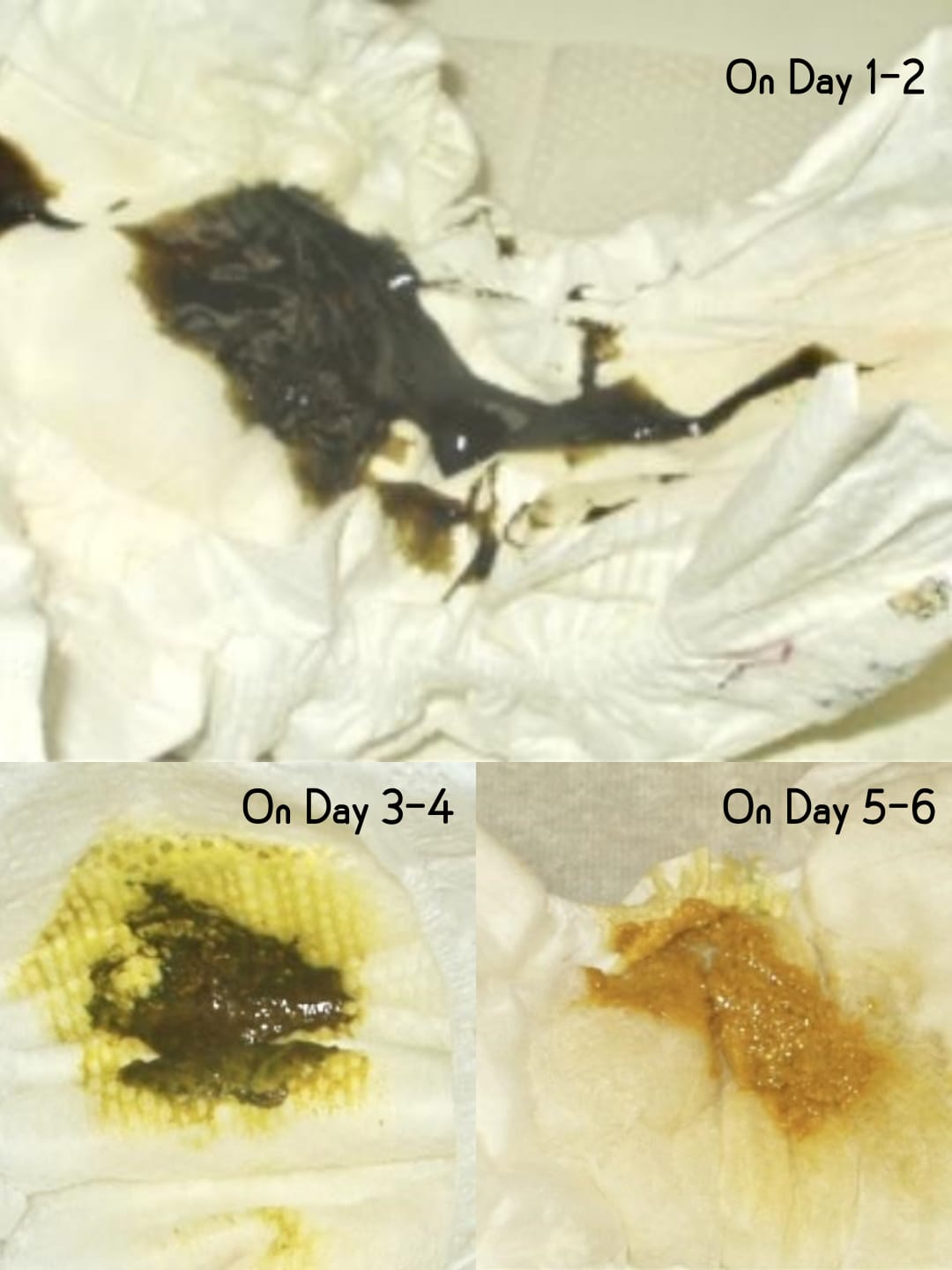 Understanding Your Baby’s Urine and Stool Patterns